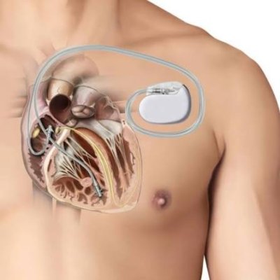 images (7).jpeg images (7).jpeg